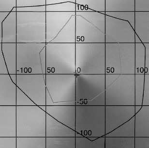 ���� ��������� ������